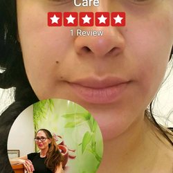 blackhead removal mask recipe top rated electric blackhead remover