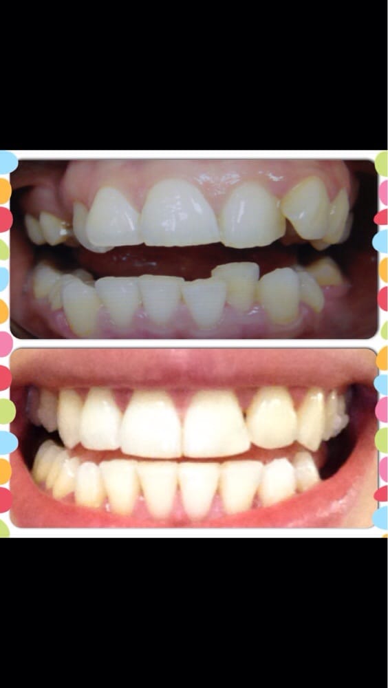 Premier Dental Associates of Lower Manhattan 20 Photos Cosmetic