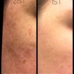 Complete Dermatology - 25 Photos & 41 Reviews - Dermatologists - 15200