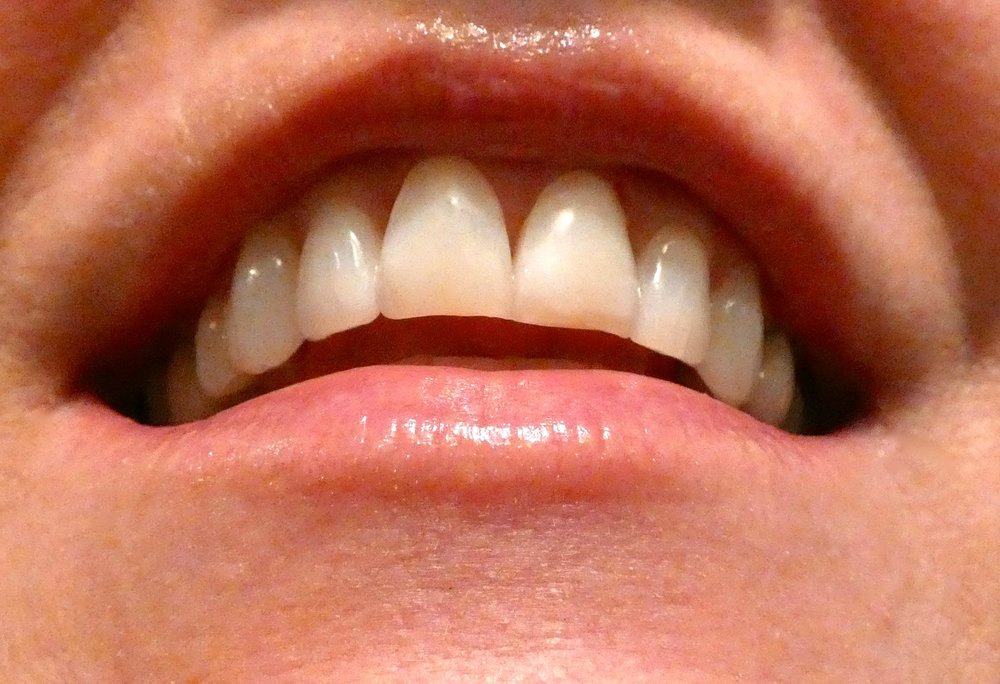 image of business Alvarado Dental Group