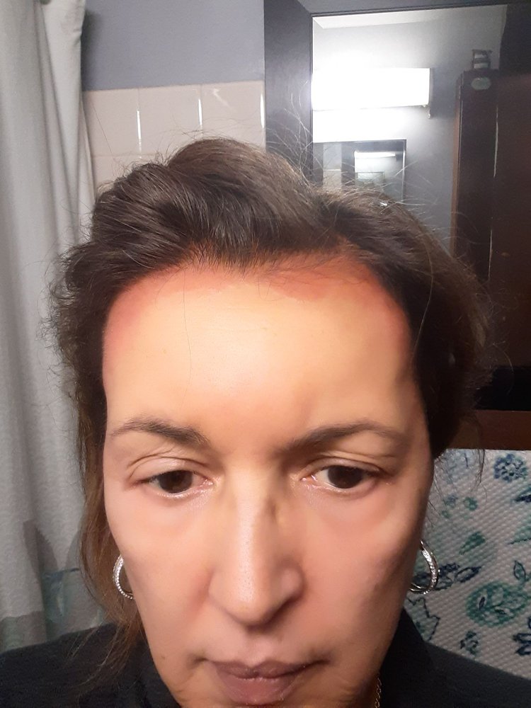 O