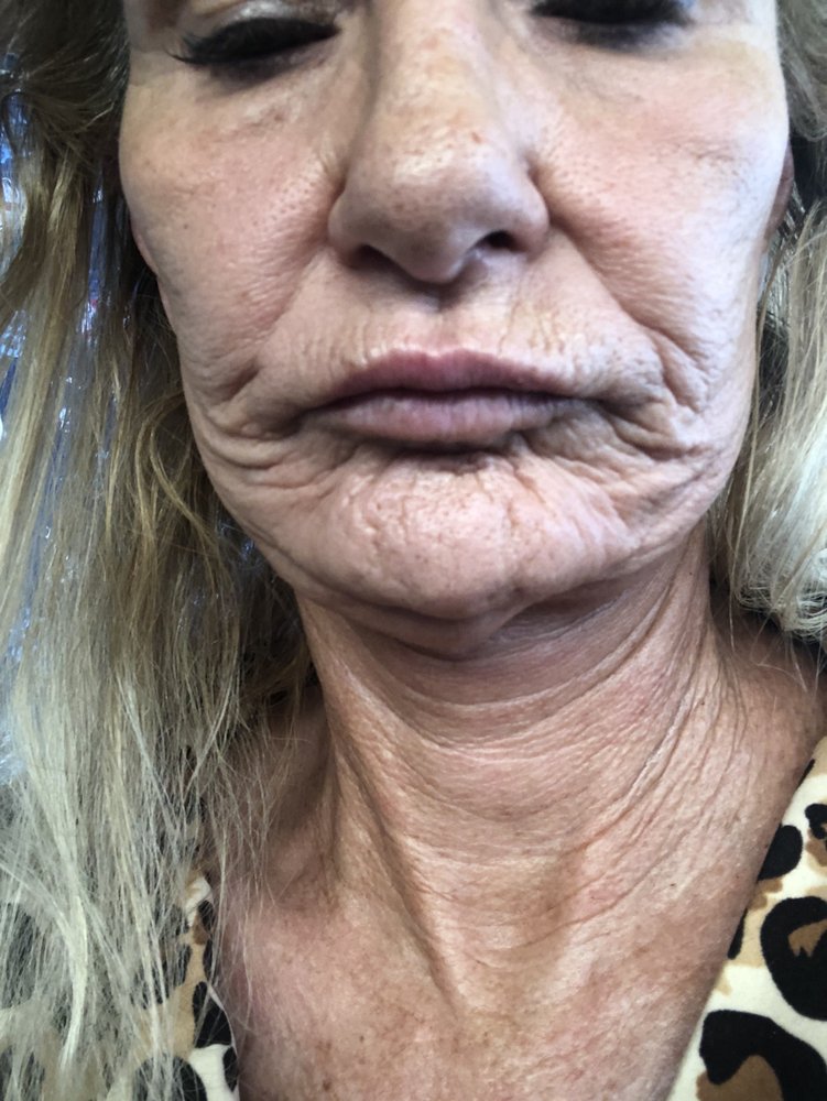 O