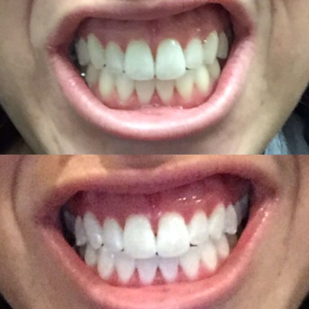 image of business Farmington Ave Dental Care
