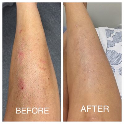 Dermatology Partners of Western Ny Llp