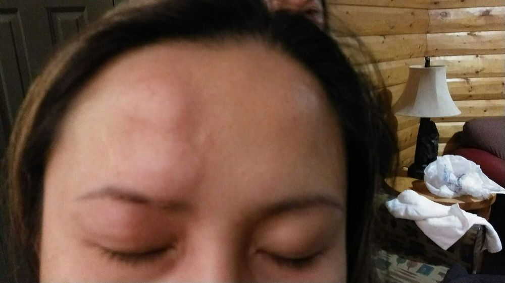 wisconsin dells bed bugs