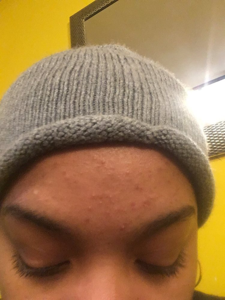 O