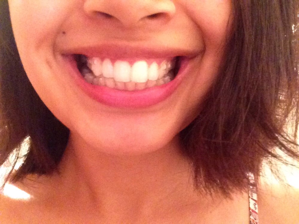 SDDS Dental 11 Photos & 44 Reviews Cosmetic Dentists 6663 Ming