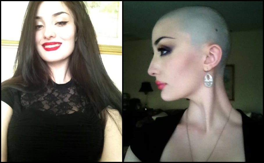 A Before And After Ronnie Did An Amazing Job With The Shave I