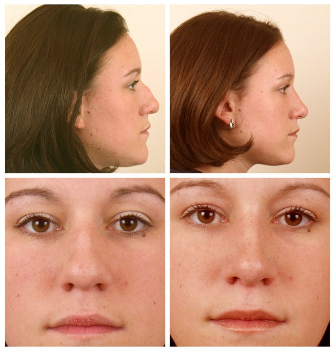 facial plastic surgery in texas Sexy witch screen saver