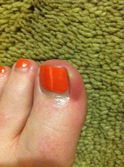 Got An Infection From This Nasty Unsanitary Nail Salon On Both Photo Of Bernal Heights Nails Care San Francisco Ca United States Got