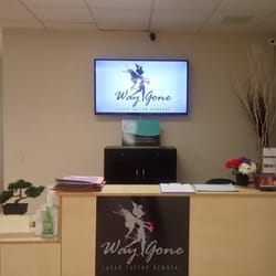 way gone laser tattoo removal 121 photos u0026 76 reviews tattoo way gone laser tattoo removal 121 photos u0026 76 reviews tattoo