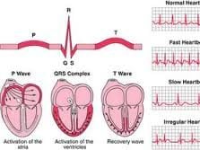 Jamespond busty vixen Cardiac rhythm strip analysis