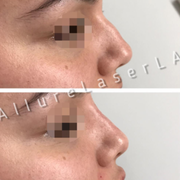 infinity medspa 50 photos u0026 259 reviews laser hair removal infinity medspa 50 photos u0026 259 reviews laser hair removal