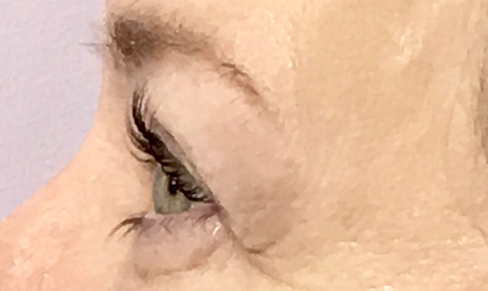 Mountcastle Medical Spa & Laser Center