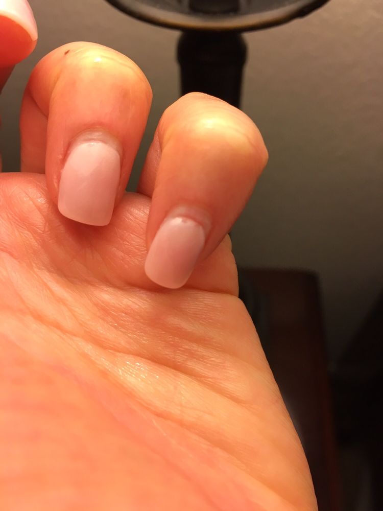 Gouge Line At Nail Bed That Is Red And Bruised From Over Zealous Photo Of Yeah 1 Nails Bar Plano Tx United States Gouge Line