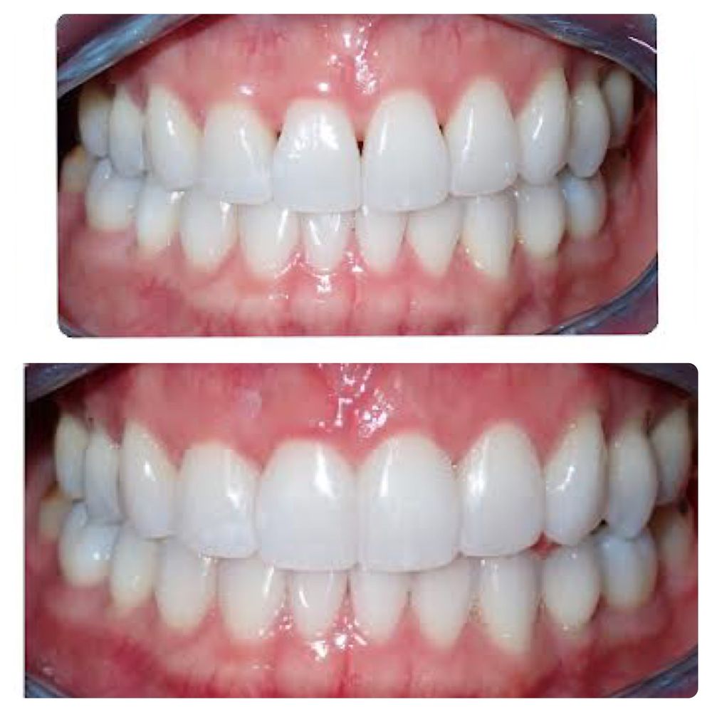 image of business Blossom Valley Smiles Dental Group & Orthodontics