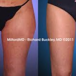 Diets to lose belly fat and love handles photo 8