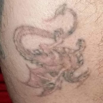 way gone laser tattoo removal 121 photos u0026 76 reviews tattoo way gone laser tattoo removal 121 photos u0026 76 reviews tattoo