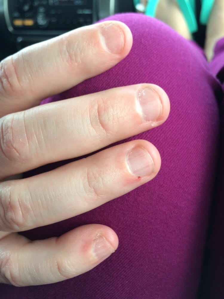 The Hack Job They Did On My Husband Jagged Nails Untrimmed Photo Of Pink Polish Nail Salon Yorba Linda Ca United States The