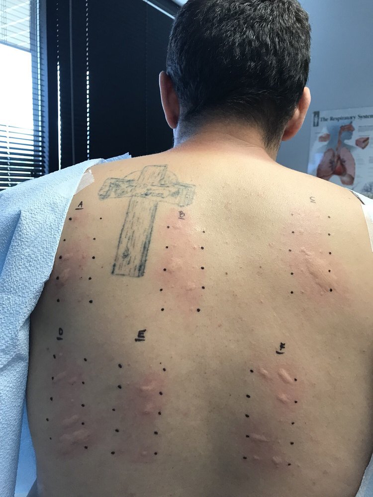 Ashburn Allergy