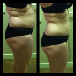 How can i lose my belly fat in 10 days image 6