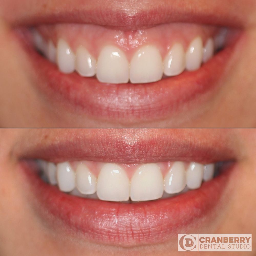 image of business Cranberry Dental Studio