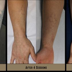 free my ink tattoo removal 4945 lapalco boulevard marrero la free my ink tattoo removal 4945 lapalco boulevard marrero la