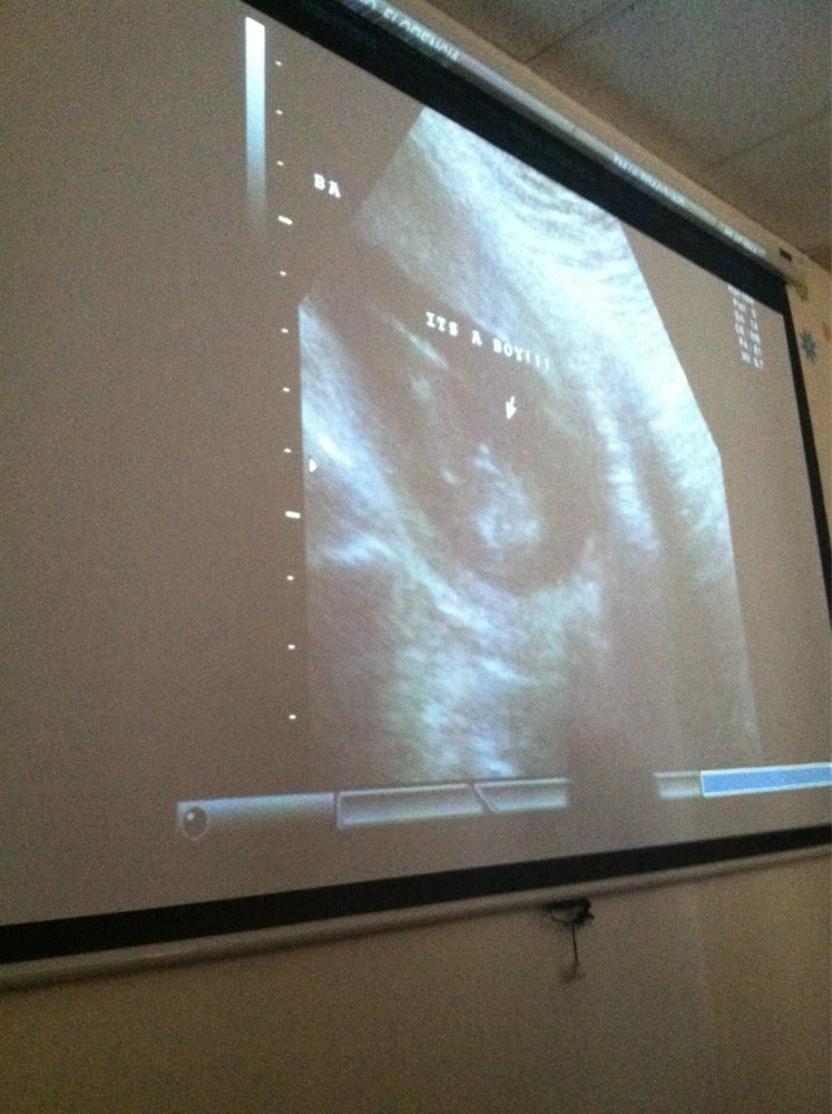 Treasured Moments Ultrasound 17 Photos & 43 Reviews Diagnostic