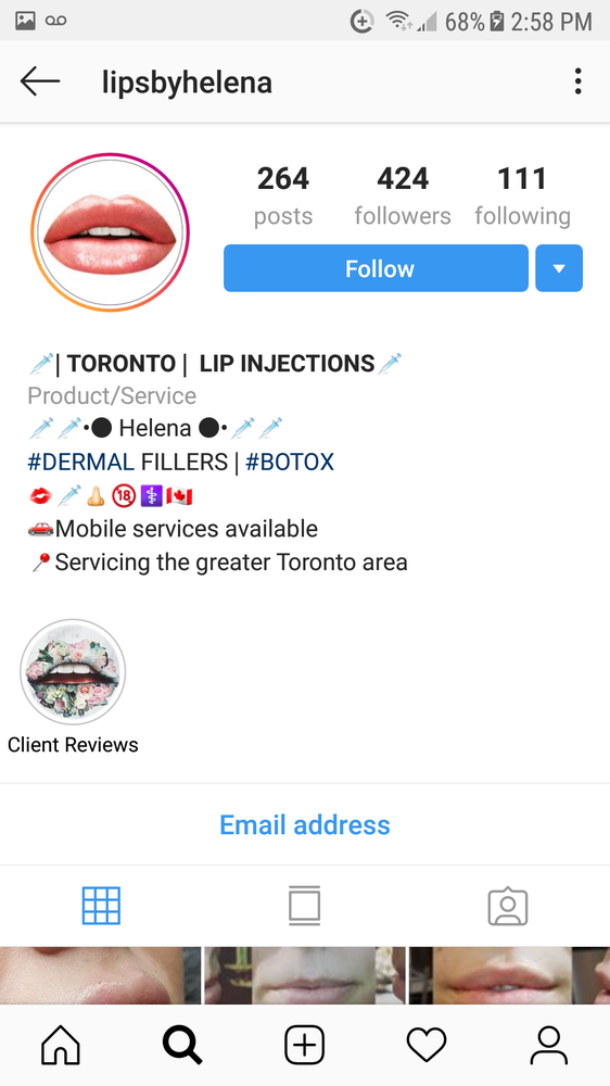 Lips by Helena