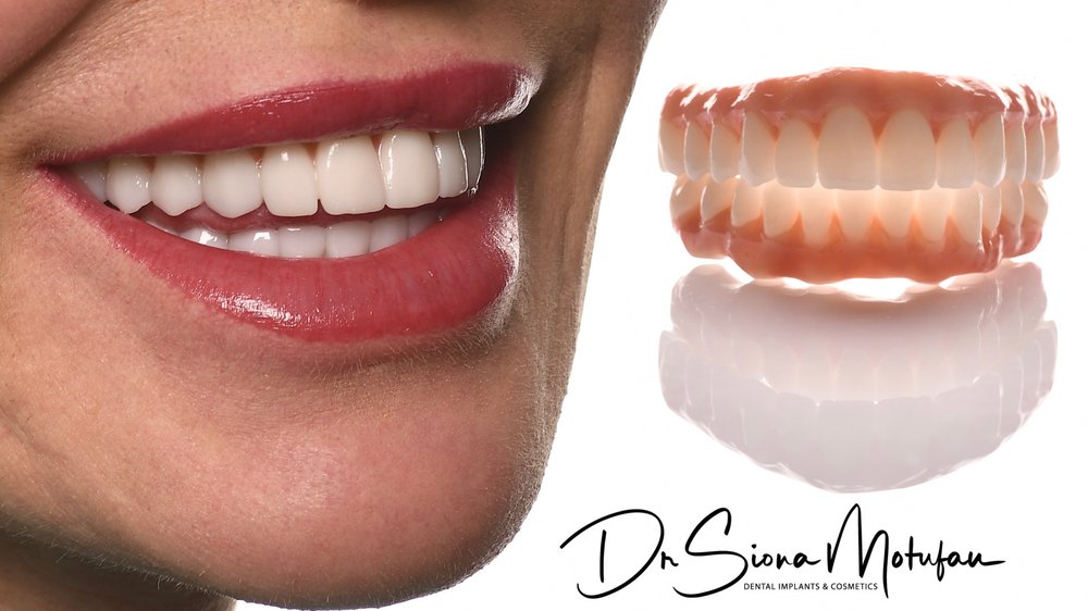 image of business Ohana Dental Implant Centers