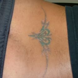 tat2 removers 14 reviews tattoo removal 2600 s lp w fwy tat2 removers 14 reviews tattoo removal 2600 s lp w fwy