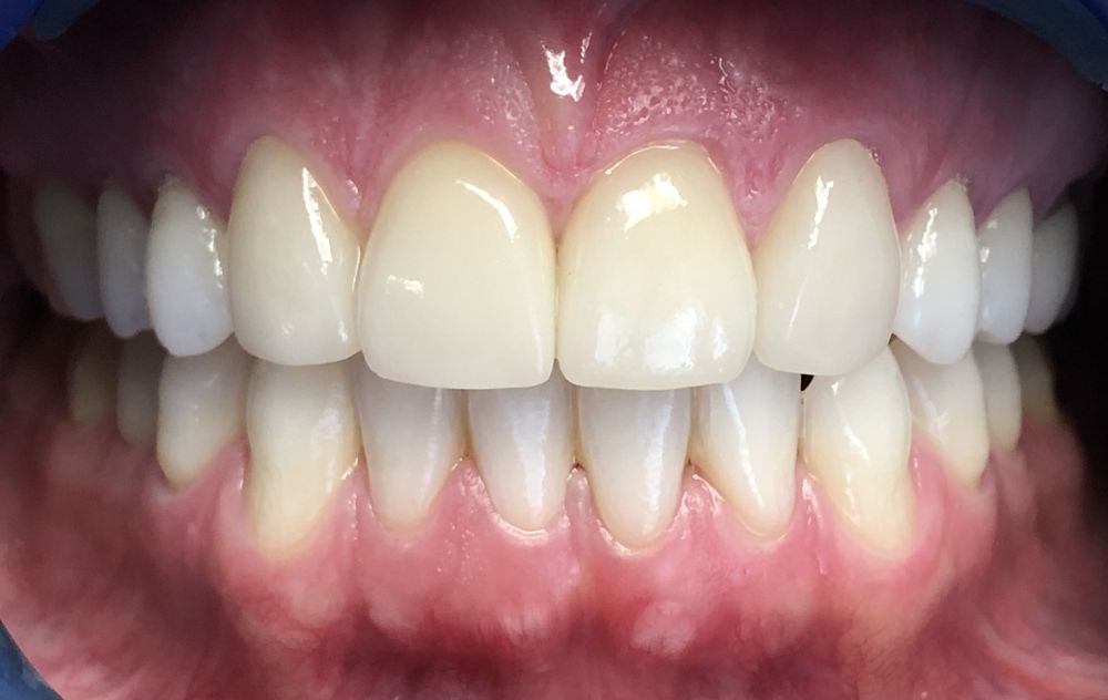 K  Douglas Barker, DMD - Newport Center Smile Design