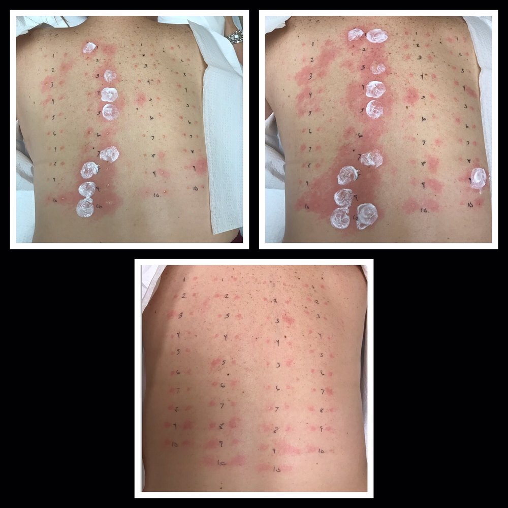 image of business Otto Liao, MD - TLC Allergy & Asthma