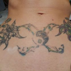 sound tattoo removal tattoo removal 32014 32nd ave s federal sound tattoo removal tattoo removal 32014 32nd ave s federal
