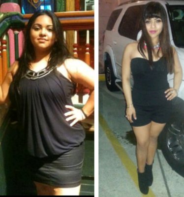 Weight loss clinics in sacramento