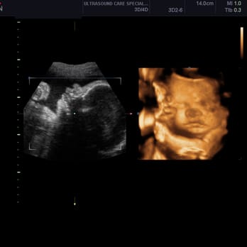 ultrasounds orlando