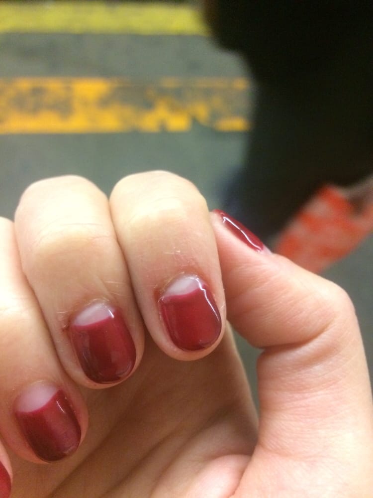 2 Of The 3 Bleeding Nail Beds They Cut Other Is On My Hand Photo Of Pretty Polished New York Ny United States 2 The