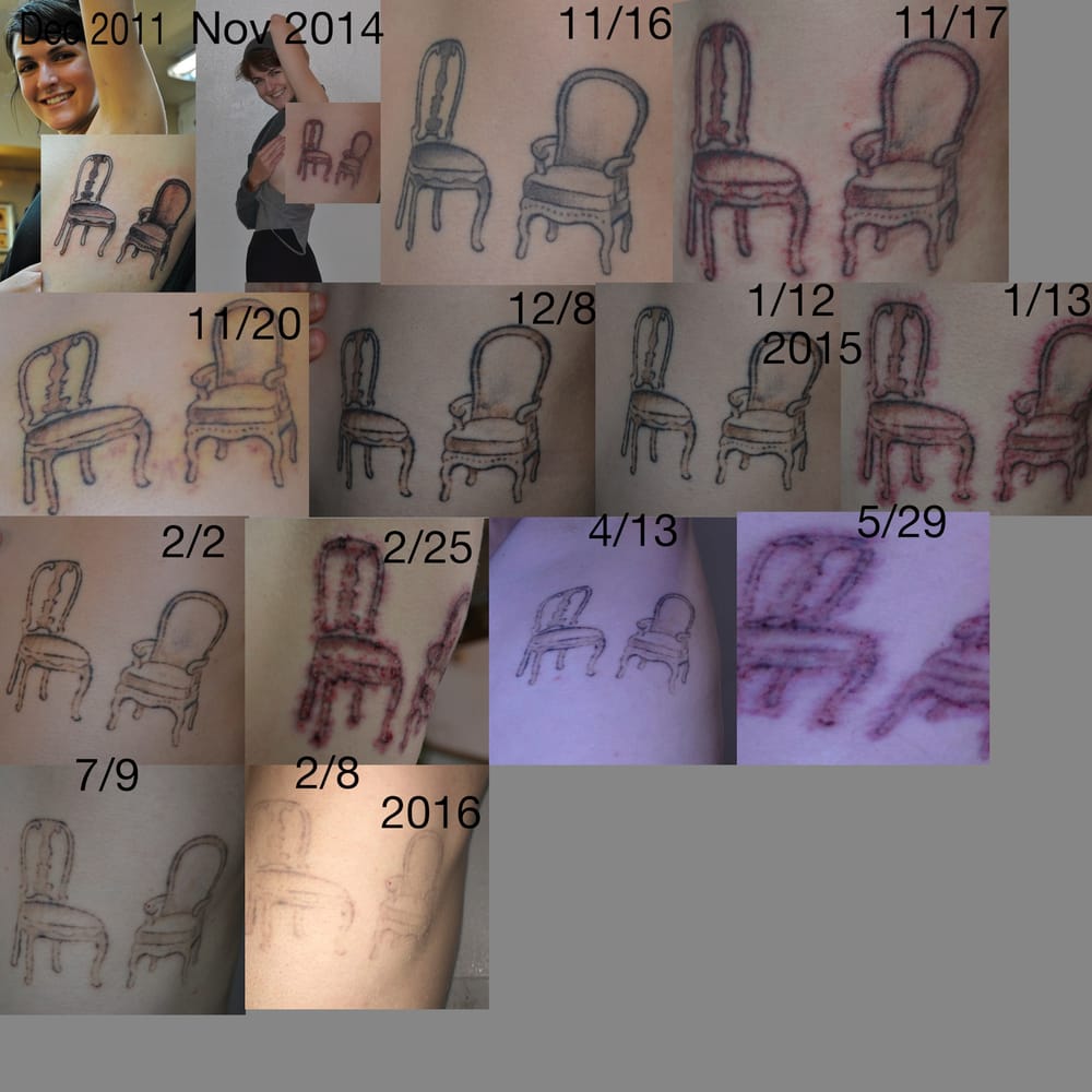 project erase tattoo removal tattoo removal 1719 w burnside st project erase tattoo removal tattoo removal 1719 w burnside st