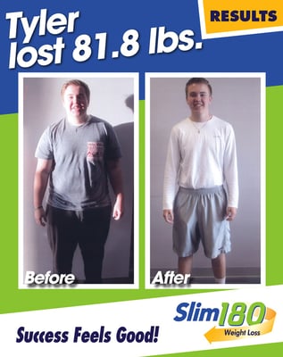 Slim 180 Sunset Hills 3828 S Lindbergh Blvd Ste 102 Saint Louis Mo Photos 10