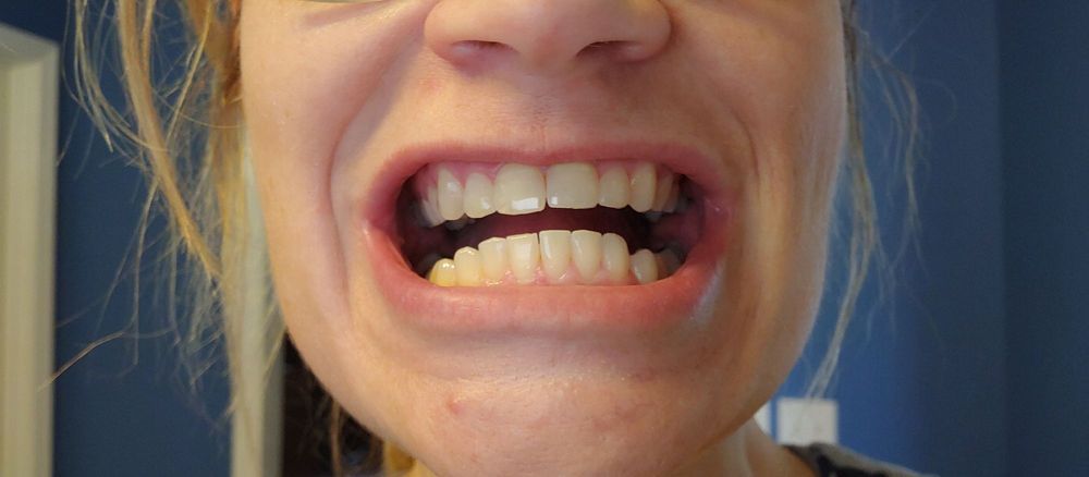 image of business Smile Direct Club