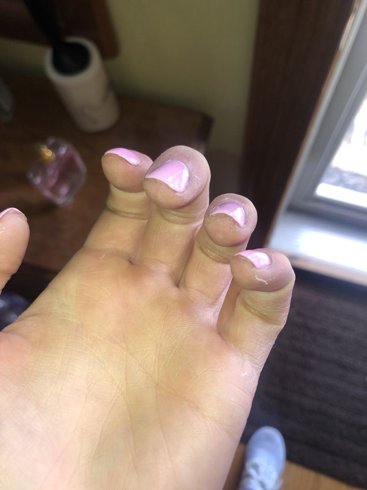 O
