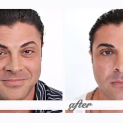 Photo Of Garo Kassabian Md Facs Lift Md Aesthetics Beverly Hills Photo Of Garo Kassabian Md Facs Lift Md Aesthetics Beverly Hills