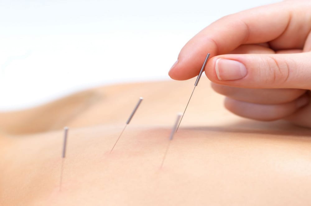 Xu Ri Acupuncture & Herb Clinic Bronx Acupuncture 984 Morris Park