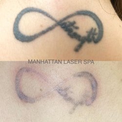 The Laser Place White Plains Ny Last Updated May 2019 Yelp