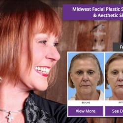 Aesthetic care facial midwest plastic skin surgery Homade spunk videos