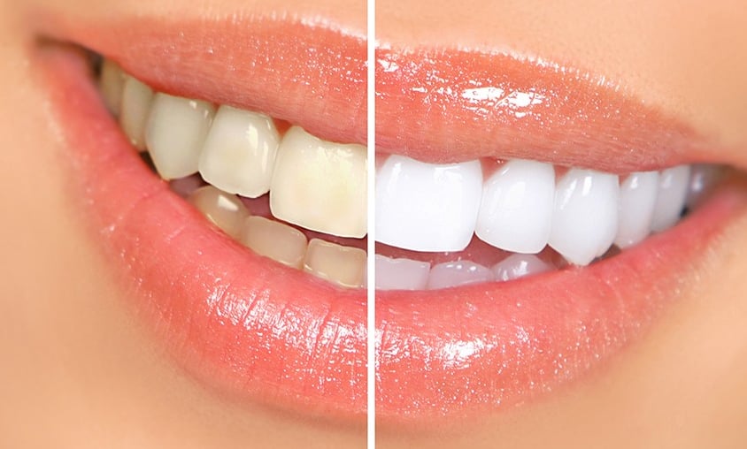 image of business North Hunterdon Dental Associates