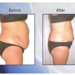 Garcinia cambogia extract vitacost picture 10
