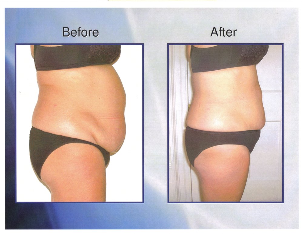 Naturewise garcinia cambogia instructions image 9