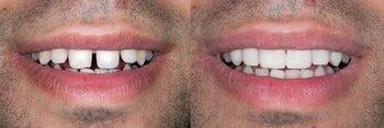 image of business Acton Family Dental Care