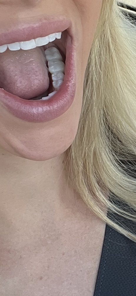 image of business Young Family Dental Saratoga Springs